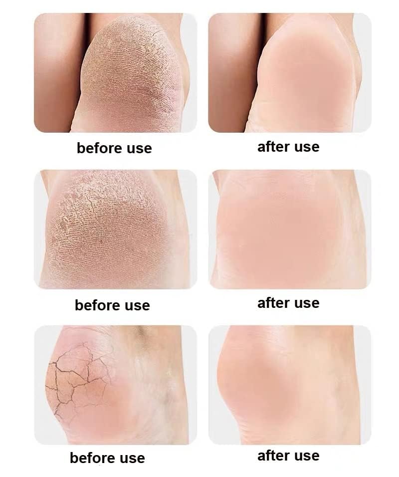 Hydrating Silicone Moisturizing Socks for Women & Men - (Pack of 2, Random Colors)