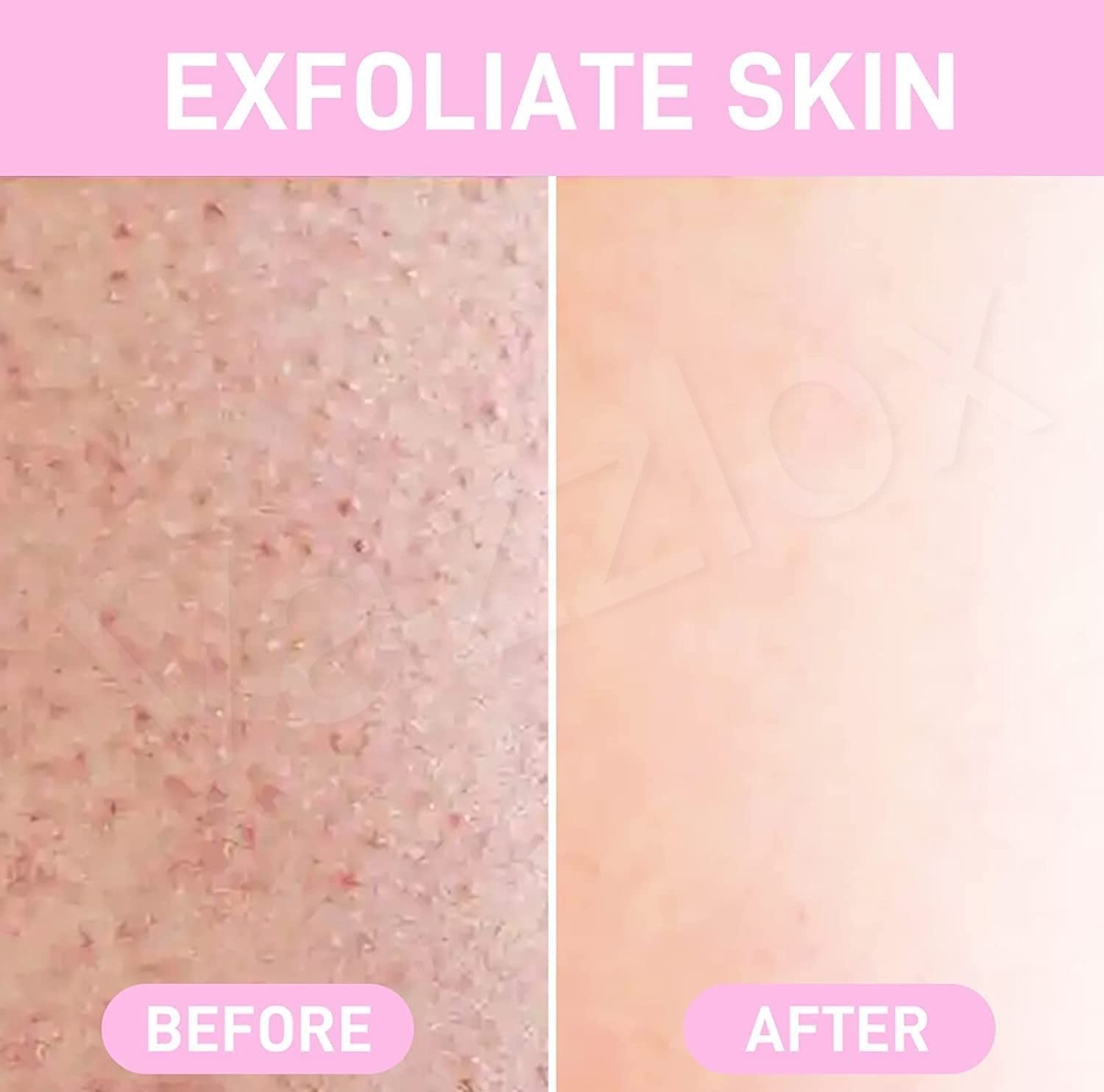 Crystal Hair Eraser - Magic Painless Hair Remover for Men & Women - (Random Colour)