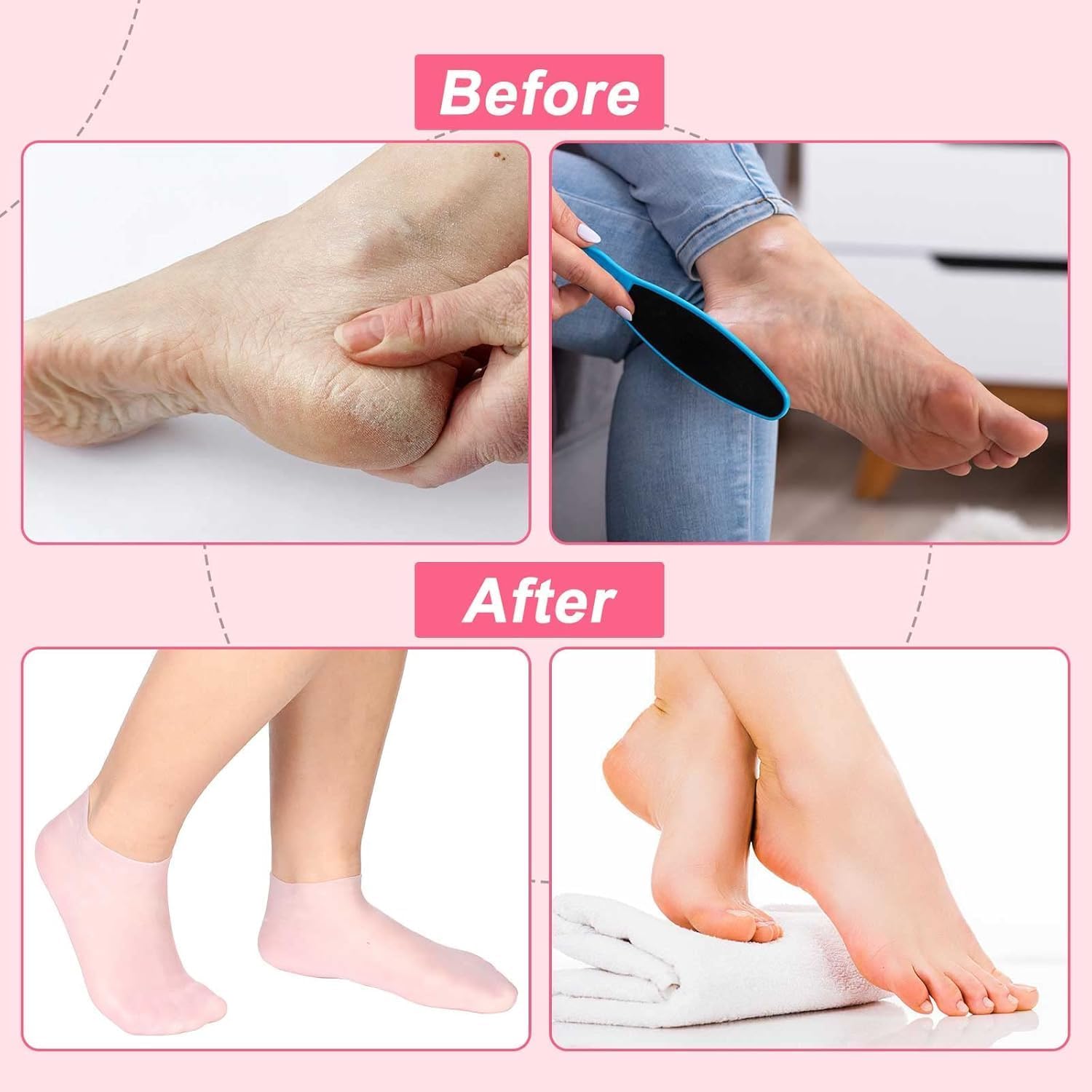 Hydrating Silicone Moisturizing Socks for Women & Men - (Pack of 2, Random Colors)